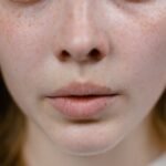 Skincare Routine for Combination Skin: Stop Treating Your Whole Face the Same Way