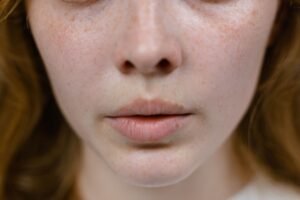 Skincare Routine for Combination Skin: Stop Treating Your Whole Face the Same Way
